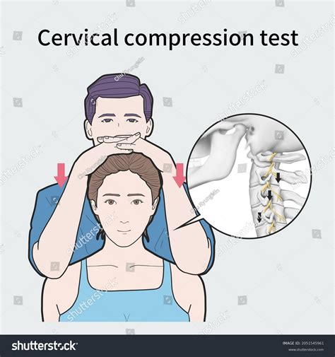 compression test spine|cervical compression test physical therapy.